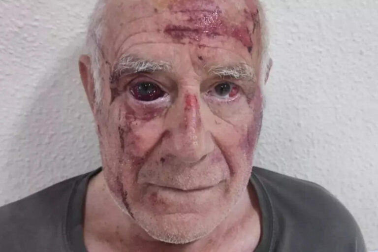 Inmigrantes ilegales marroquíes intentaron asesinar a un anciano español