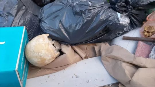 Hallaron un cráneo humano dentro de un volquete en el inicio de temporada en Mar del Plata